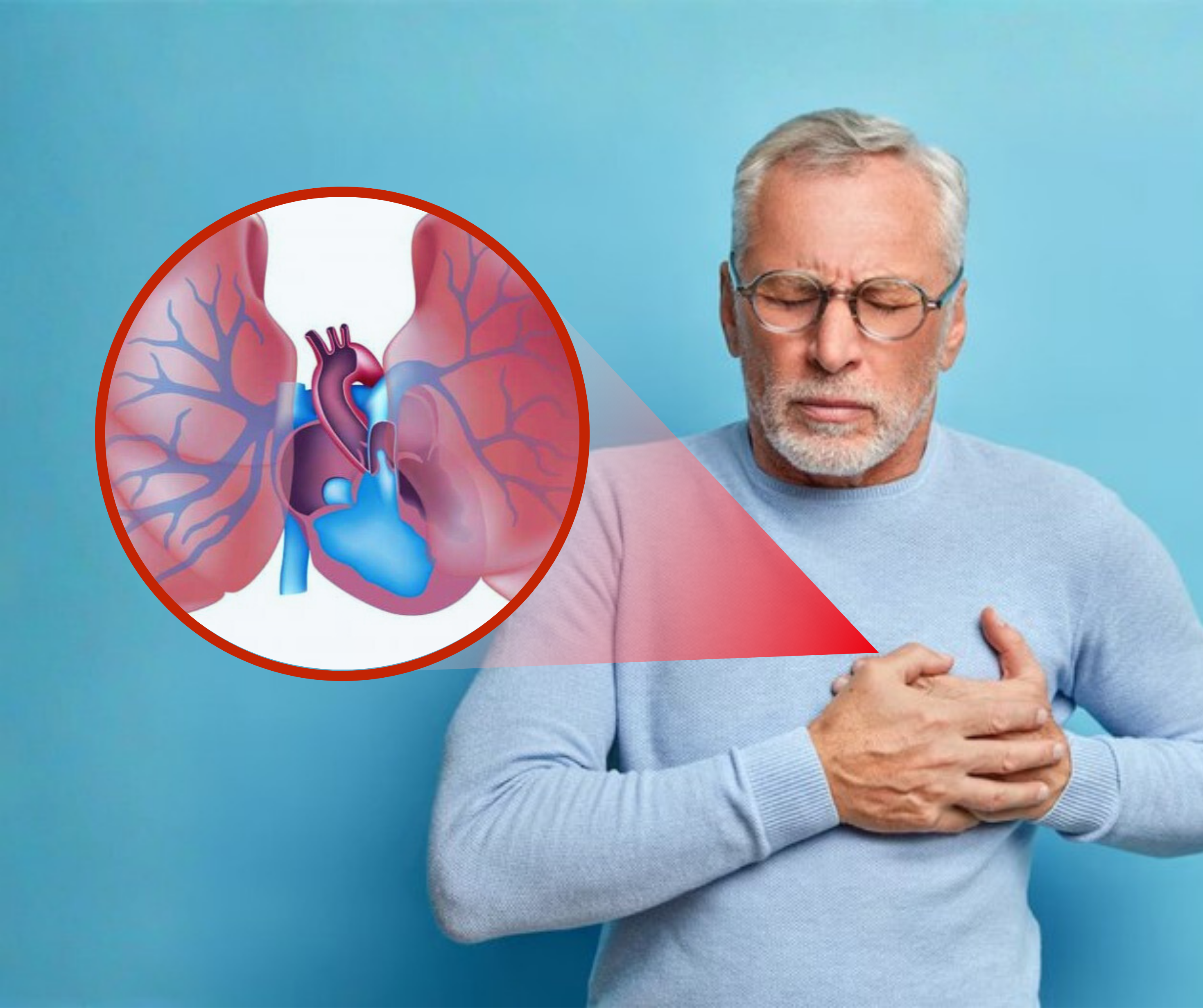 Order testing for Pulmonary Arterial Hypertension PAH